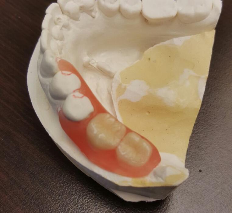 gallery-one-artisan-denture-clinic